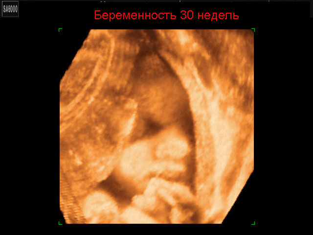 31 недель 6 дней. Плод на 30 неделе беременности. Плод при беременности 30 недель. Ребёнок в 30 недель беременности. 30 Недель беременности фото.