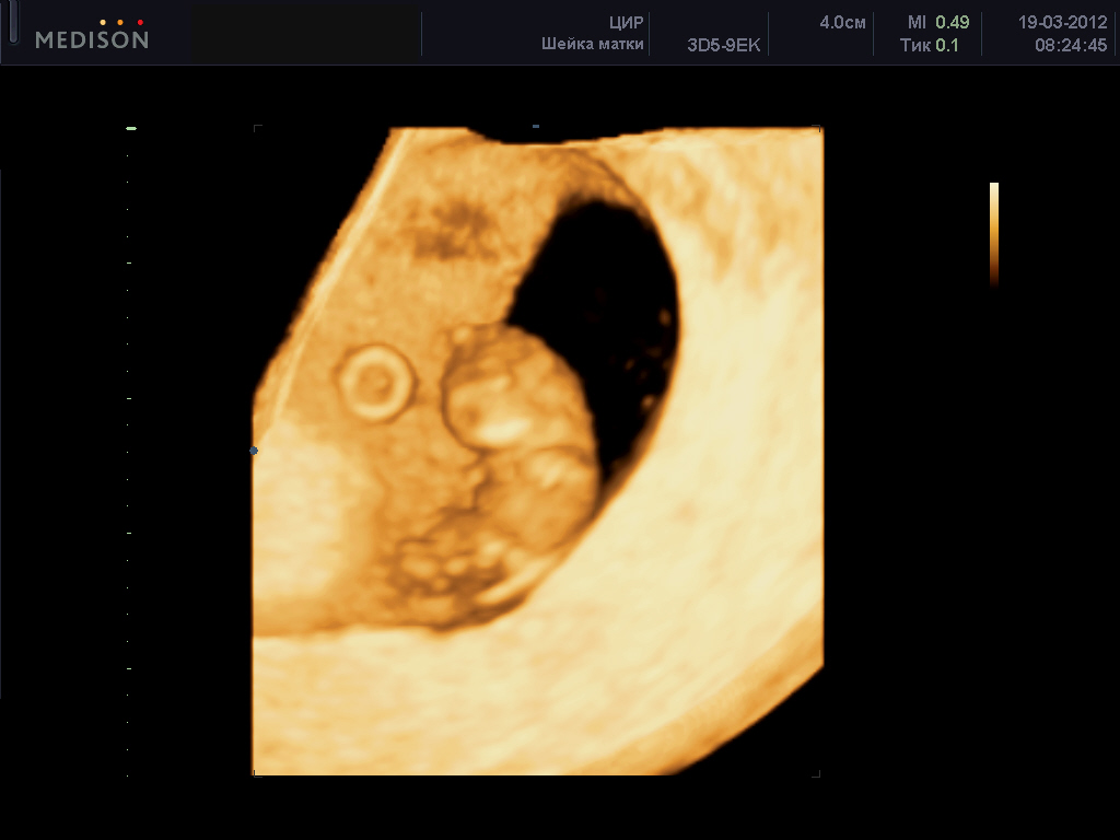 Беременность 7 8 недель фото эмбриона на узи