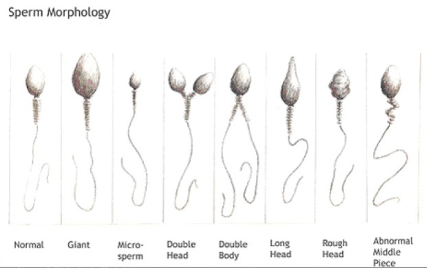 Спермограмма - где сдать анализ? | Спермограмма и мужская фертильность