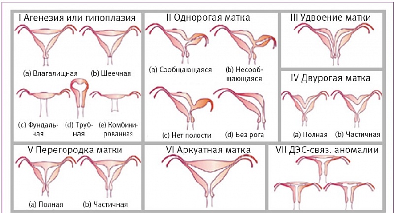 Классификация AFS.jpg